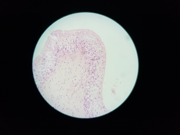 Transitional Epithelium Slides - Transitional Epithelium 02 400X